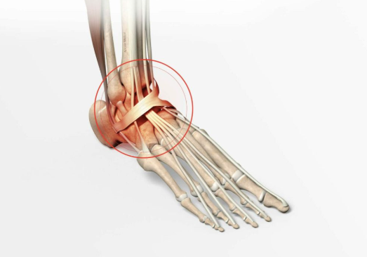 Traitement de l’ostéochondrite